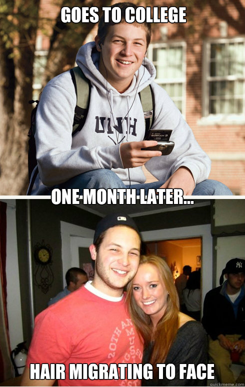 Goes to college one month later... hair migrating to face  1 month later