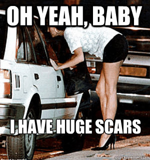 Oh yeah, baby i have huge scars

  Karma Whore