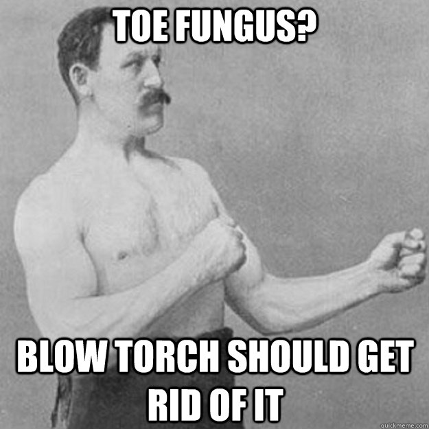 Toe fungus? Blow torch should get rid of it  overly manly man