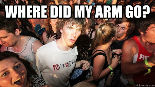 Where did my arm go?   Sudden Clarity Clarence