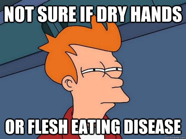 Not sure if dry hands Or flesh eating disease  Futurama Fry