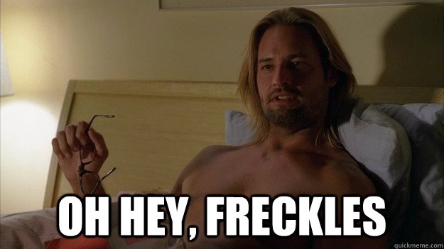  Oh hey, freckles -  Oh hey, freckles  Sexy Sawyer