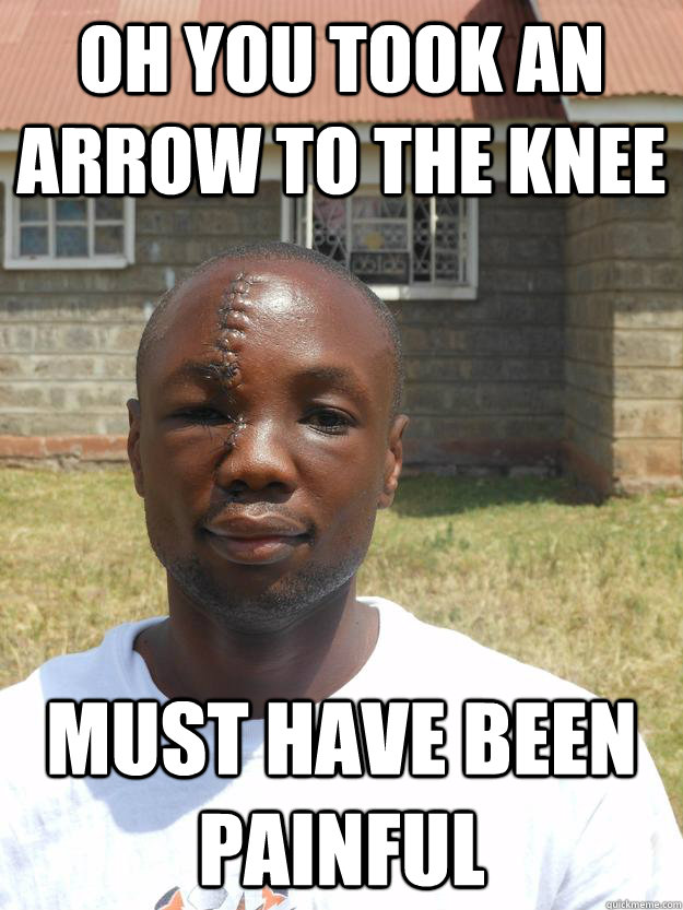 Oh you took an arrow to the knee Must have been painful - Oh you took an arrow to the knee Must have been painful  Overly Awesome Omari