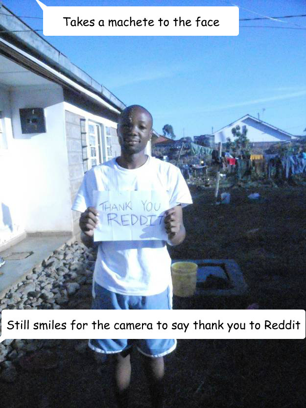 Takes a machete to the face Still smiles for the camera to say thank you to Reddit - Takes a machete to the face Still smiles for the camera to say thank you to Reddit  GOOD GUY OMARI