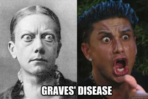 GRAVES' DISEASE - GRAVES' DISEASE  Pauly Disease
