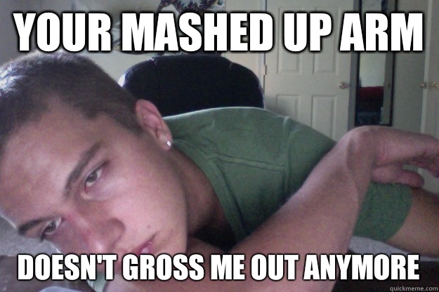 Your mashed up arm Doesn't gross me out anymore  Hardcore Redditor
