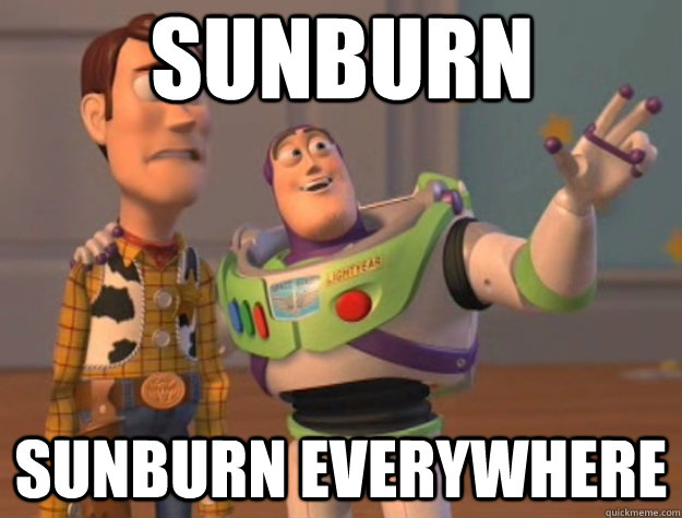Sunburn Sunburn everywhere  Toy Story