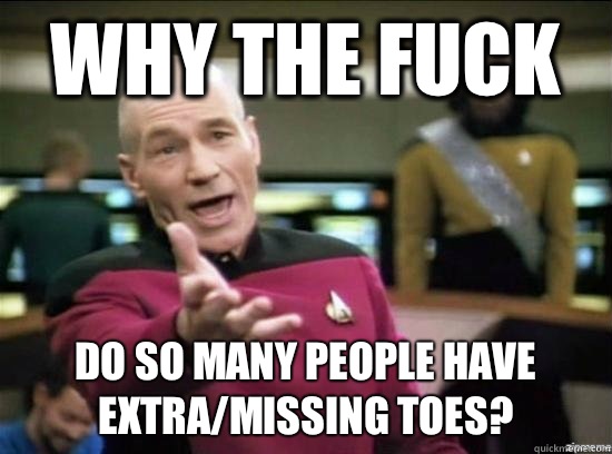 Why the fuck Do so many people have extra/missing toes?  Annoyed Picard HD