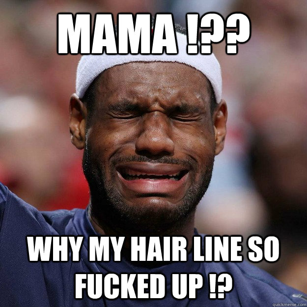 mAMA !?? Why my hair line so fucked up !?  Lebron Crying