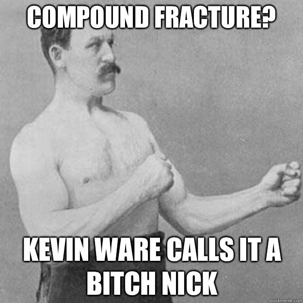 Compound fracture? Kevin Ware calls it a bitch nick  overly manly man