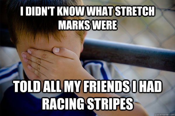 I didn't know what stretch marks were told all my friends I had racing stripes - I didn't know what stretch marks were told all my friends I had racing stripes  Confession kid