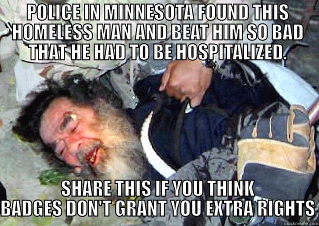 POLICE IN MINNESOTA FOUND THIS HOMELESS MAN AND BEAT HIM SO BAD THAT HE HAD TO BE HOSPITALIZED. SHARE THIS IF YOU THINK BADGES DON'T GRANT YOU EXTRA RIGHTS Misc