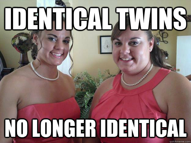 Identical twins no longer identical  Fat Twin