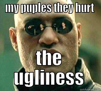 MY PUPLES THEY HURT THE UGLINESS Matrix Morpheus