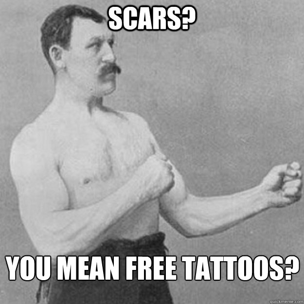 Scars? You mean free tattoos?  overly manly man