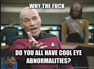 why the fuck do you all have cool eye abnormalities? - why the fuck do you all have cool eye abnormalities?  Annoyed Picard
