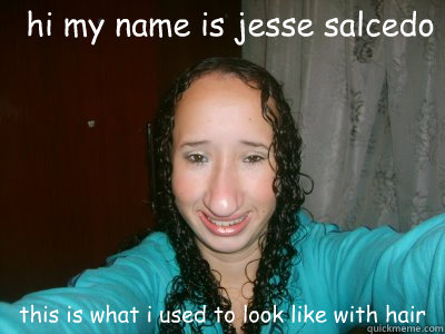 hi my name is jesse salcedo this is what i used to look like with hair  