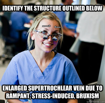 ------> <---- Identify the structure outlined below Enlarged supertrochlear vein due to rampant, stress-induced, bruxism  overworked dental student