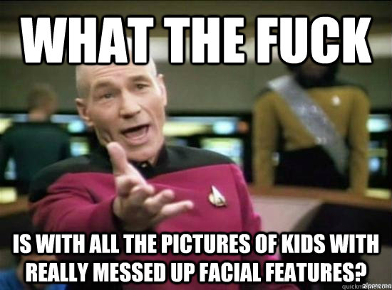 What the fuck Is with all the pictures of kids with really messed up facial features?  Annoyed Picard HD