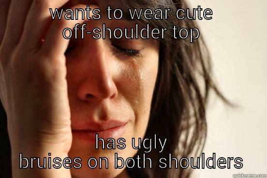 WANTS TO WEAR CUTE OFF-SHOULDER TOP HAS UGLY BRUISES ON BOTH SHOULDERS First World Problems