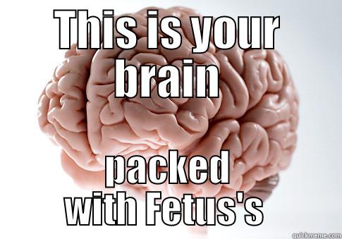 Giving Birth to Intelligence - THIS IS YOUR BRAIN PACKED WITH FETUS'S  Scumbag Brain