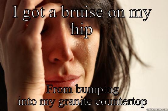 I GOT A BRUISE ON MY HIP FROM BUMPING INTO MY GRANITE COUNTERTOP First World Problems