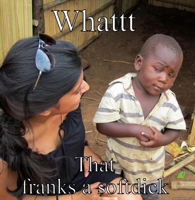 WHATTT THAT FRANKS A SOFTDICK Skeptical Third World Kid