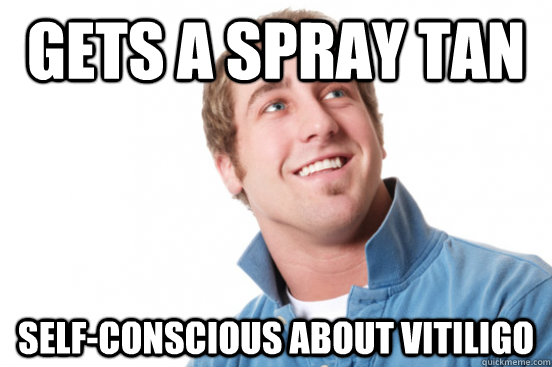 Gets a spray tan self-conscious about vitiligo  Misunderstood Douchebag
