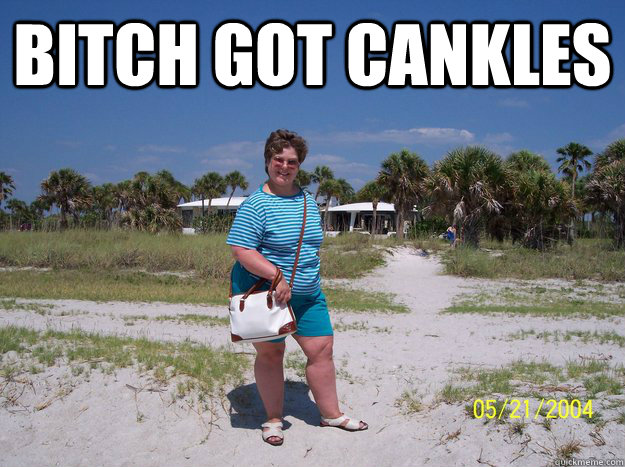 bitch got cankles  - bitch got cankles   Misc