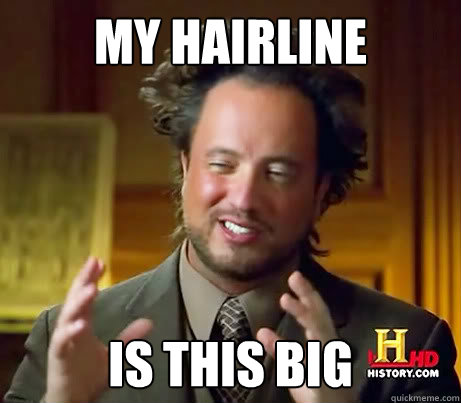 MY HAIRLINE IS THIS BIG  History Channel Guy