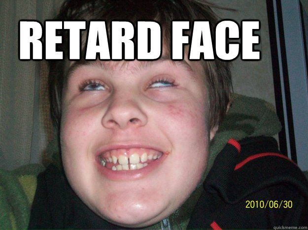 retARD FACE - retARD FACE  retard face