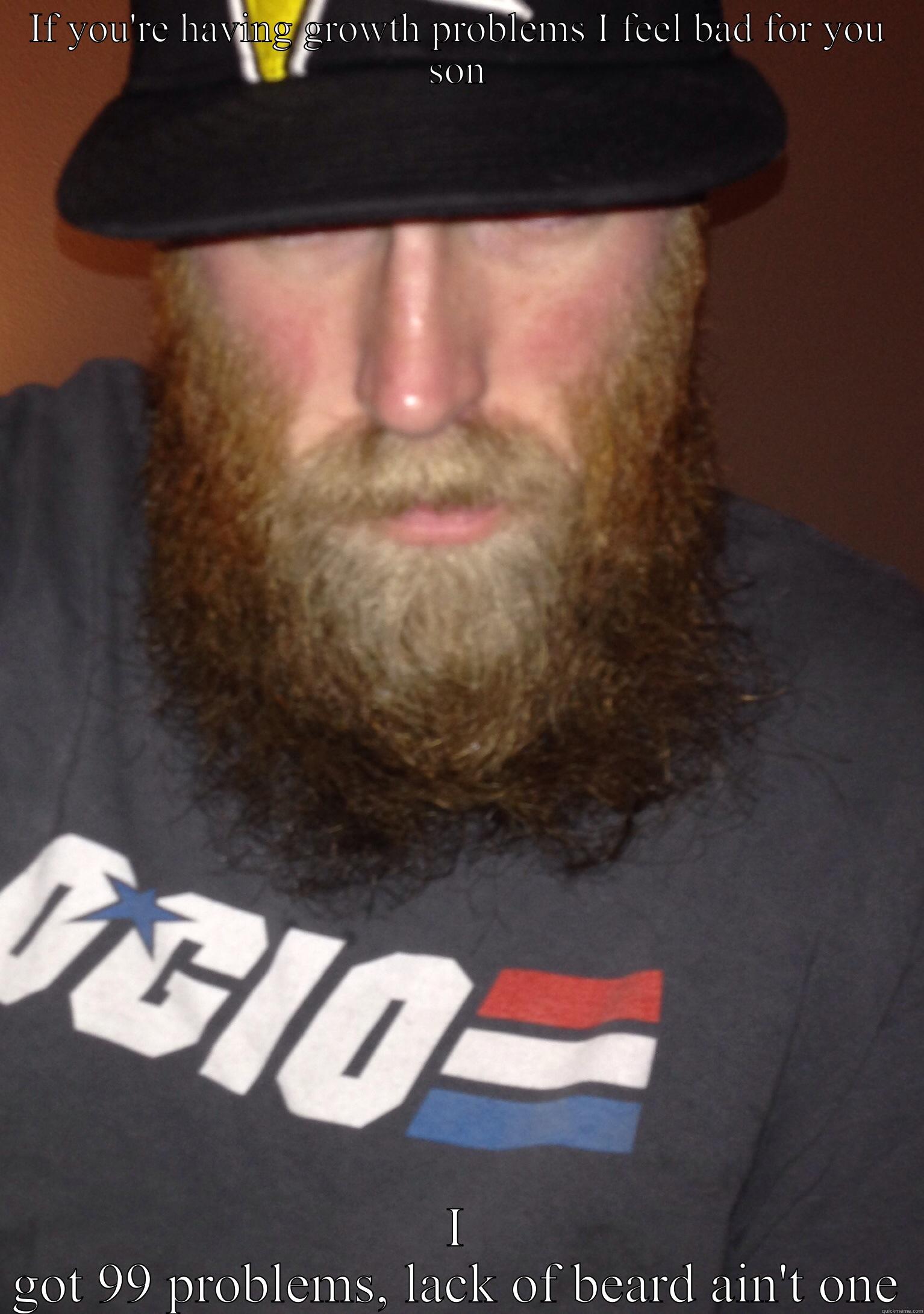 IF YOU'RE HAVING GROWTH PROBLEMS I FEEL BAD FOR YOU SON I GOT 99 PROBLEMS, LACK OF BEARD AIN'T ONE Misc