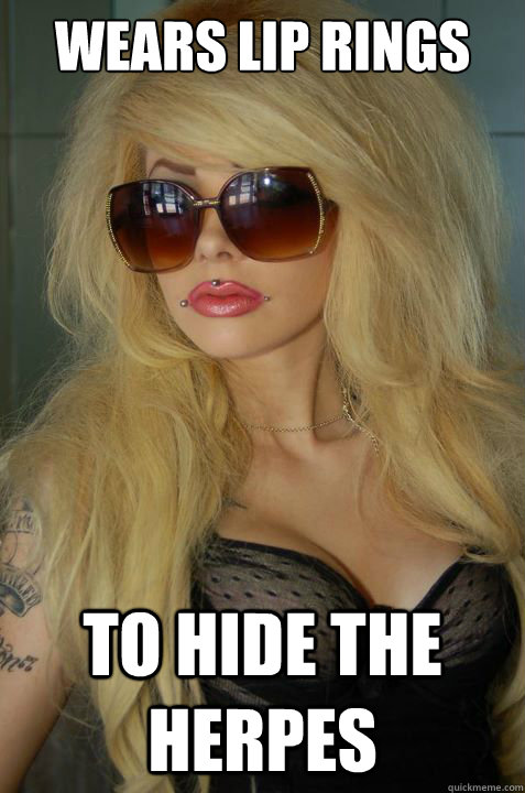 Wears lip rings To hide the herpes  