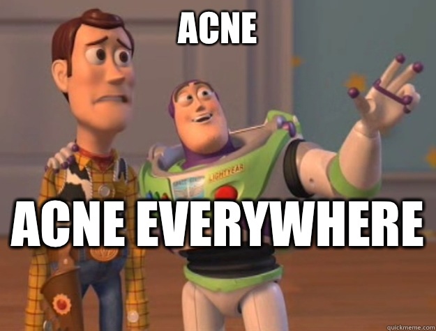 Acne Acne everywhere   Sunburns Everywhere
