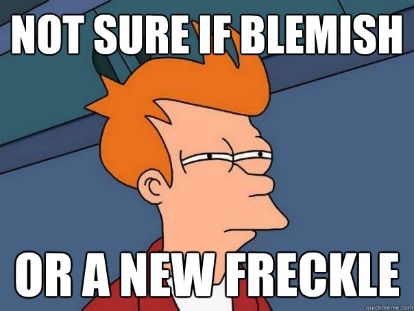 Not sure if blemish or a new freckle  Futurama Fry