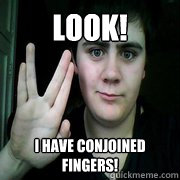 Look! I have conjoined fingers!  Jared Milton