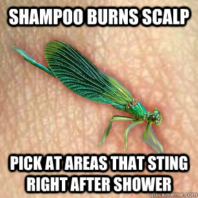 Shampoo burns scalp pick at areas that sting right after shower  Derma Dragonfly