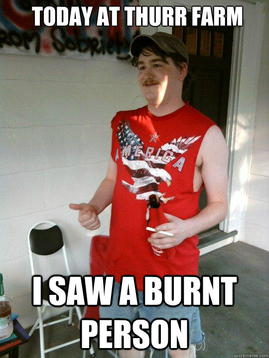 today at thurr farm i saw a burnt person  Redneck Randal