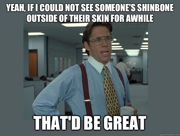 yeah, if I could not see someone's shinbone outside of their skin for awhile That'd be great  Office Space Lumbergh