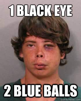 1 BLACK EYE 2 BLUE BALLS - 1 BLACK EYE 2 BLUE BALLS  SCUMBAG BRANDON ALEXANDER-MARSHALL