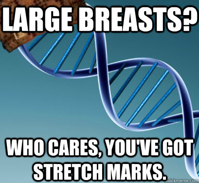 Large breasts? Who cares, you've got stretch marks.  Scumbag DNA