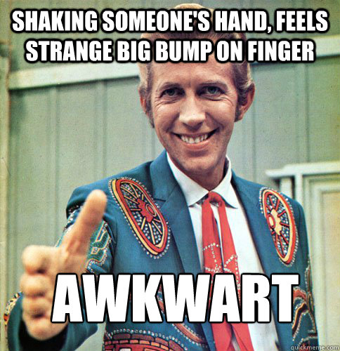 shaking someone's hand, feels strange big bump on finger awkwart - shaking someone's hand, feels strange big bump on finger awkwart  Awkwart
