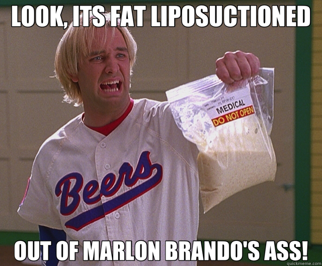 LOOK, ITS FAT LIPOSUCTIONED OUT OF MARLON BRANDO'S ASS!  