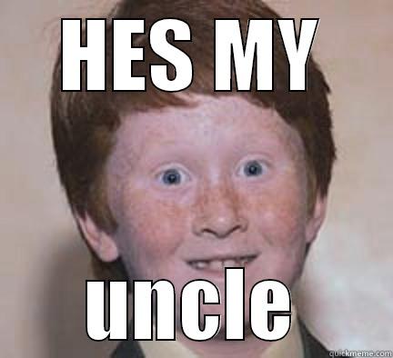 HES MY UNCLE Over Confident Ginger