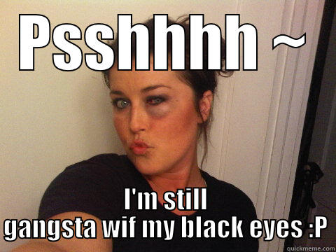 PSSHHHH ~ I'M STILL GANGSTA WIF MY BLACK EYES :P Misc
