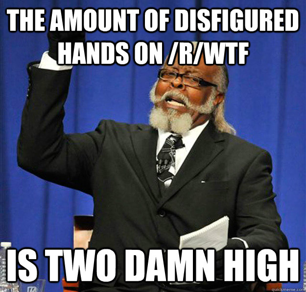 The amount of disfigured hands on /r/wtf  Is two damn high - The amount of disfigured hands on /r/wtf  Is two damn high  Jimmy McMillan