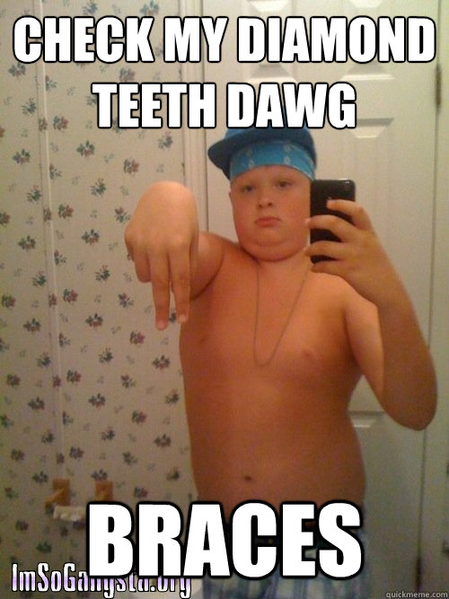 check my diamond teeth dawg braces  