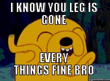 I KNOW YOU LEG IS GONE EVERY THINGS FINE BRO Misc