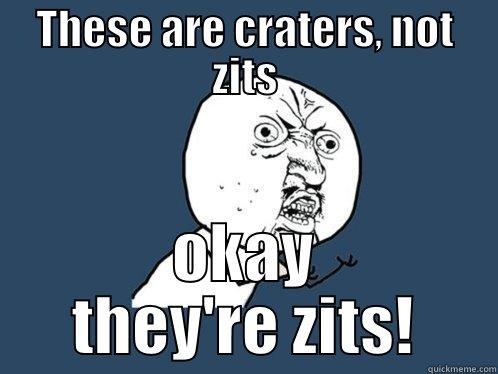 THESE ARE CRATERS, NOT ZITS OKAY THEY'RE ZITS! Y U No
