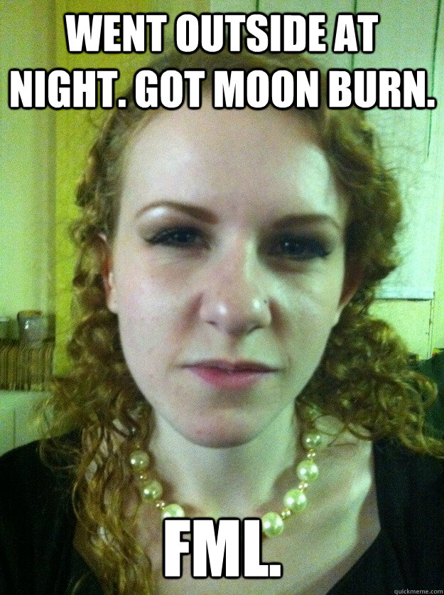 Went outside at night. Got moon burn. FML. - Went outside at night. Got moon burn. FML.  Misc